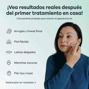 Kit de Micro-Infusión Antiedad