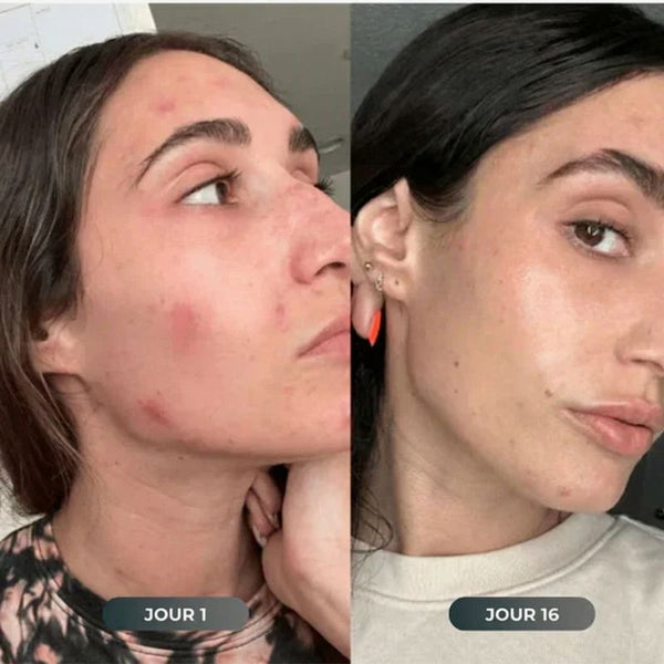 — Jade L. (Compra verificada)