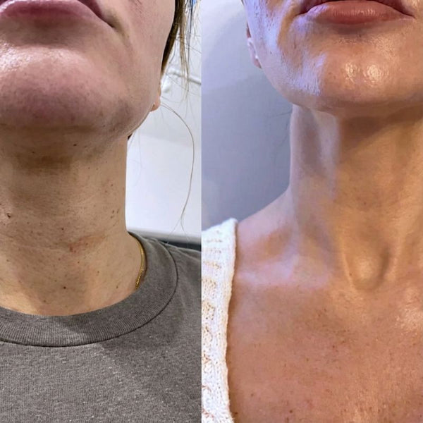 Marta G. (57 años) – Compra verificada