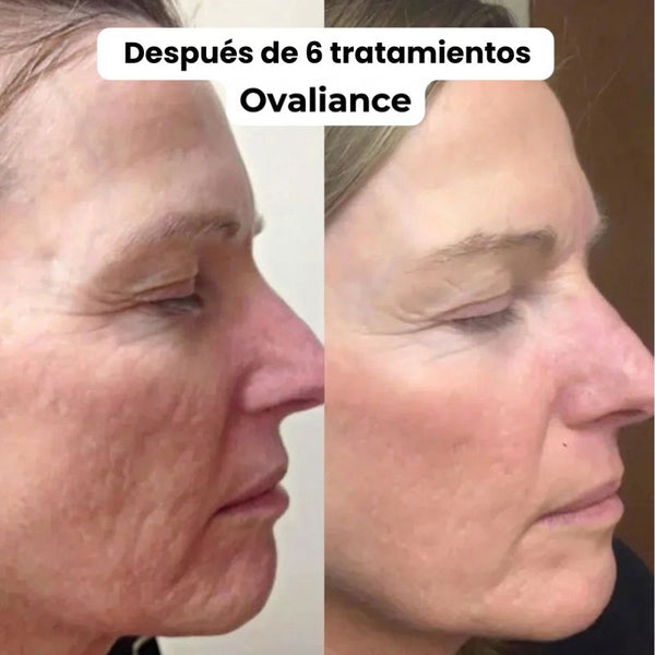 Beatriz A. (52 años) – Compra verificada