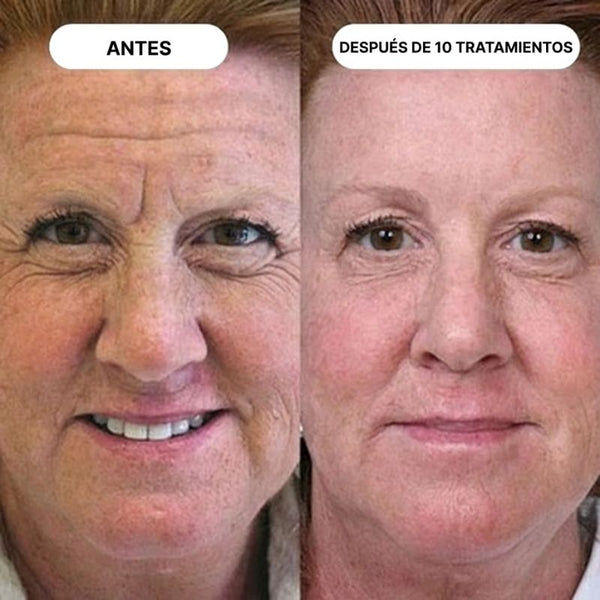 Elena S. (61 años) – Compra verificada